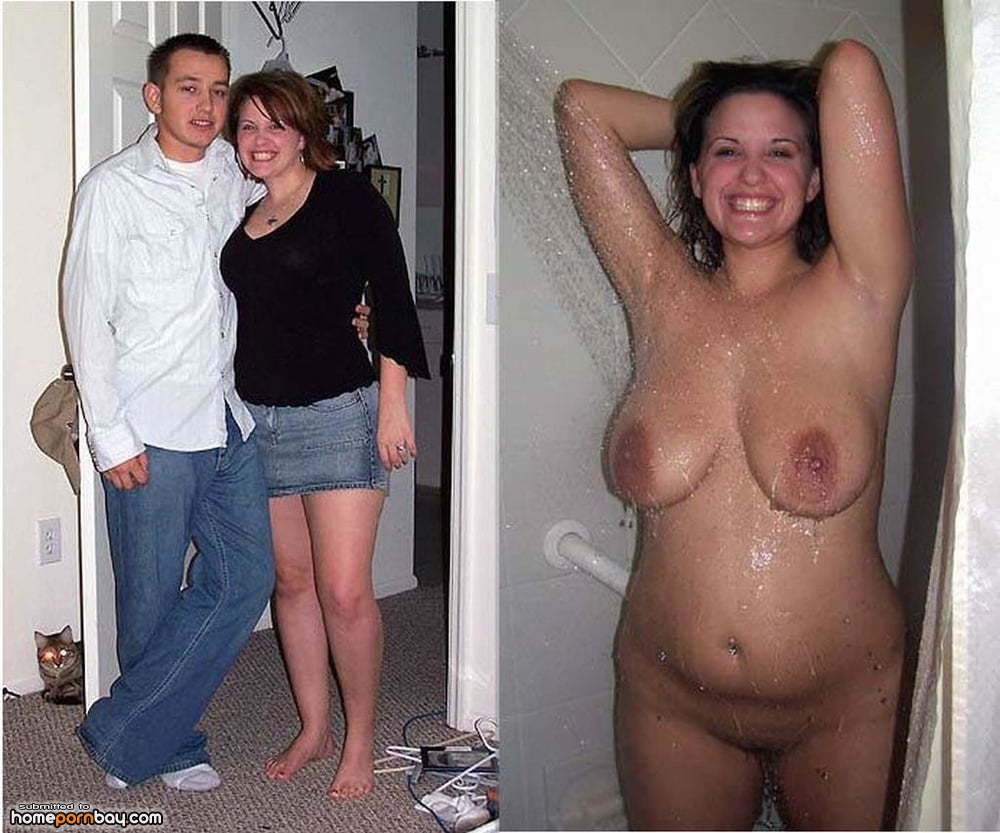 Nude women after boob job