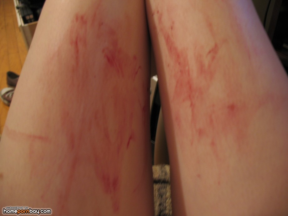 Share Mobile bloody pussy pics Can Mobile bloody pussy pics